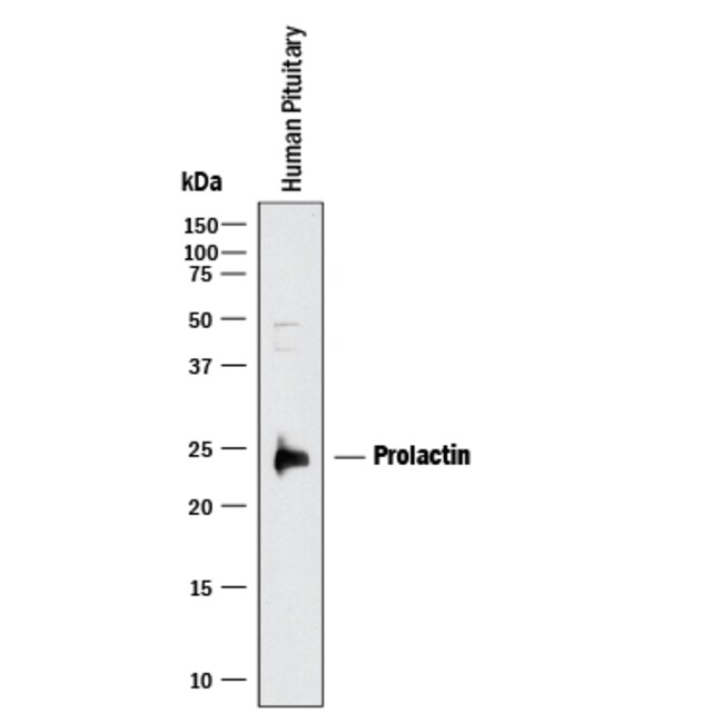 Human Prolactin Antibody 25μg; UnlabeledAntibodies, Monoclonal