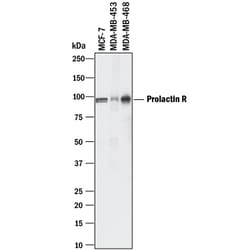 Human Prolactin R Antibody, R D Systems 25&mu;g; Unlabeled:Antibodies,