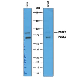Human Proprotein Convertase 9/PCSK9 Antibody, R D Systems 100&mu;g; Unlabeled:Antibodies,