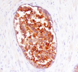 Human Prostasin/Prss8 Antibody, R D Systems 100 &mu;g | Buy Online | R&D Systems | Fisher Scientific