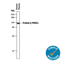 Human Protein S/PROS1 Antibody, R D Systems 100&mu;g; Unlabeled:Antibodies,