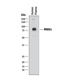 Human Protein S/PROS1 Antibody, R D Systems 25&mu;g; Unlabeled:Antikörper