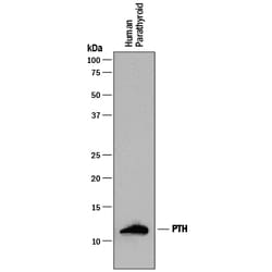 Human PTH Antibody, R D Systems 100&mu;g:Antibodies, Monoclonal