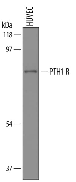 Human PTH1R/PTHR1 Antibody, R D Systems 100&mu;g; Unlabeled:Antibodies,
