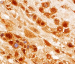 Human PTPN14 Antibody, R D Systems 25&mu;g; Unlabeled:Antibodies, Monoclonal