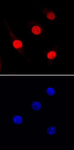 Mouse PU.1/Spi-1 Antibody, R D Systems 100ug; Unlabeled:Antibodies, Monoclonal
