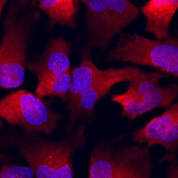 Human/Mouse PUM1 Antibody, R D Systems 25&mu;g; Unlabeled:Antibodies, Polyclonal