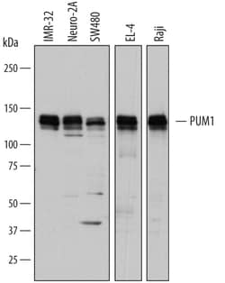 Human/Mouse PUM1 Antibody, R D Systems 25&mu;g; Unlabeled:Antibodies, Polyclonal