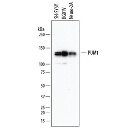 Human/Mouse PUM1 Antibody, R D Systems 25&mu;g; Unlabeled:Antibodies, Monoclonal