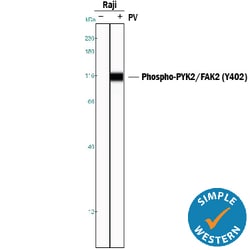 Human Phospho-PYK2/FAK2 (Y402) Antibody, R D Systems 25&mu;g; Unlabeled:Antibodies,