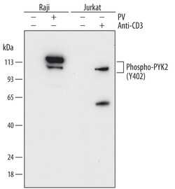 Human Phospho-PYK2/FAK2 (Y402) Antibody, R D Systems 25&mu;g; Unlabeled:Antibodies,
