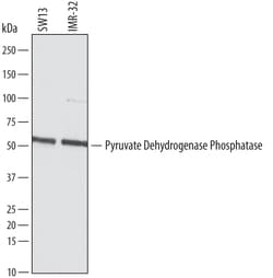 Human Pyruvate Dehydrogenase Phosphatase/PDP1 Antibody, R D Systems 100&mu;g;