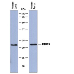 Human Rab13 Antibody, R D Systems 25&mu;g; Unlabeled:Antibodies, Monoclonal
