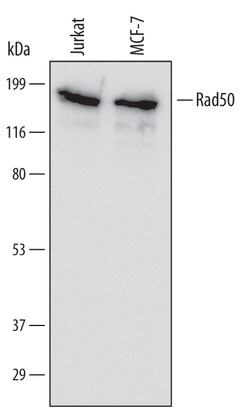 Human Rad50 Antibody, R D Systems 100ug; Unlabeled:Antibodies, Monoclonal