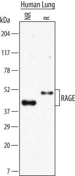 Human RAGE Antibody, R D Systems 500 &mu;g | Buy Online | R&D Systems | Fisher Scientific