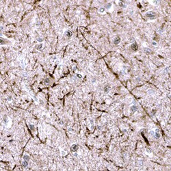 Human RAMP1 Antibody, R D Systems 25&mu;g; Unlabeled:Antibodies, Polyclonal