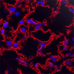 Mouse RAMP2 Antibody, R D Systems 100ug; Unlabeled:Antibodies, Monoclonal