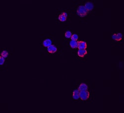 Human RARRES3 Antibody, R D Systems 100ug; Unlabeled:Antibodies, Monoclonal