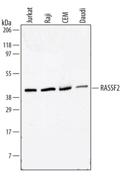 Human/Mouse RASSF2 Antibody, R D Systems 25&mu;g; Unlabeled:Antibodies,
