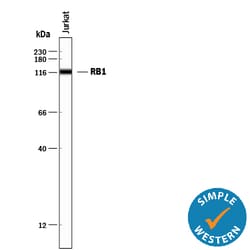 Human RB1 Antibody, R D Systems 100ug; Unlabeled:Antibodies, Monoclonal