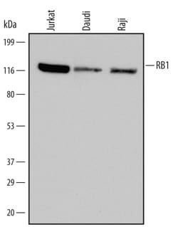 Human RB1 Antibody, R D Systems 100ug; Unlabeled:Antibodies, Monoclonal