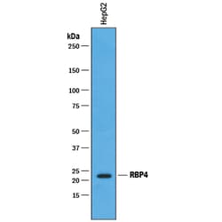 Human RBP4/Retinol-Binding Protein 4 Antibody, R D Systems 100&mu;g; Unlabeled:Anticuerpos