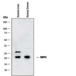 Human/Mouse RBP4/Retinol-Binding Protein 4 Antibody, R D Systems 100ug;