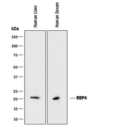Human/Mouse RBP4/Retinol-Binding Protein 4 Antibody, R D Systems 25&mu;g;