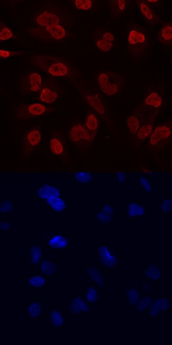 Human RCOR1/CoREST Antibody, R D Systems 100ug; Unlabeled:Antibodies, Monoclonal