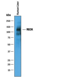 Human RECK Antibody, R D Systems 25&mu;g; Unlabeled:Antibodies, Polyclonal