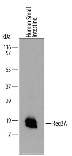 Human Reg3A Antibody, R D Systems 100ug; Unlabeled:Antibodies, Monoclonal