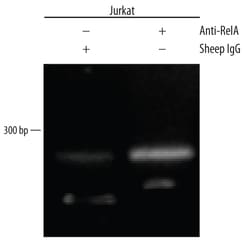 Human/Mouse/Rat RelA/NF kappa B p65 Antibody, R D Systems 25&mu;g; Unlabeled:Antibodies,