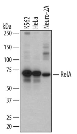 Human/Mouse/Rat RelA/NF kappa B p65 Antibody, R D Systems 25&mu;g; Unlabeled:Antibodies,