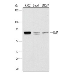 Human/Mouse/Rat RelA/NF kappa B p65 Antibody, R D Systems 25&mu;g; Unlabeled:Antibodies,