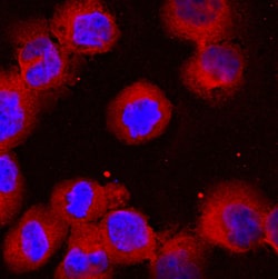Human/Mouse/Rat RelA/NF kappa B p65 Antibody, R D Systems 25&mu;g; Unlabeled:Antibodies,