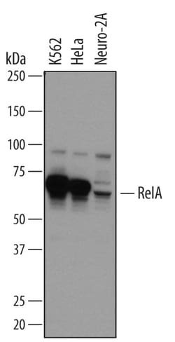 Human/Mouse/Rat RelA/NF kappa B p65 Antibody, R D Systems 25&mu;g; Unlabeled:Antibodies,