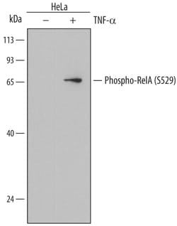 Human Phospho-RelA/NFkB p65 (S529) Antibody, R D Systems 100ug; Unlabeled:Antibodies,