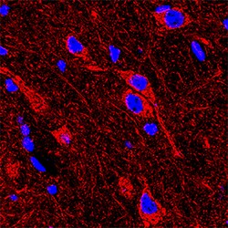 Human/Mouse/Rat Relaxin R1 Antibody, R D Systems:Antibodies:Primary Antibodies