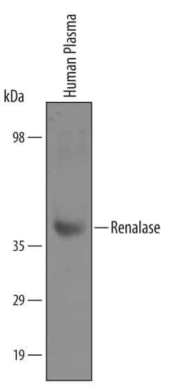 Human Renalase Antibody, R D Systems 25&mu;g; Unlabeled:Antibodies, Polyclonal