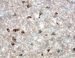 Mouse Resistin Antibody, R D Systems 100 &mu;g | Buy Online | R&D Systems | Fisher Scientific