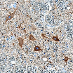 Human Ret Antibody, R D Systems 100&mu;g; Unlabeled:Antibodies, Polyclonal