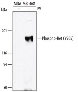Human Phospho-Ret (Y905) Antibody, R D Systems 50&mu;g; Unlabeled:Antibodies,
