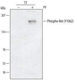 Human Phospho-Ret (Y1062) Antibody, R D Systems 25&mu;g; Unlabeled:Antibodies,