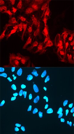 Human Rex-1/ZFP42 Antibody, R D Systems 25&mu;g; Unlabeled:Antibodies,
