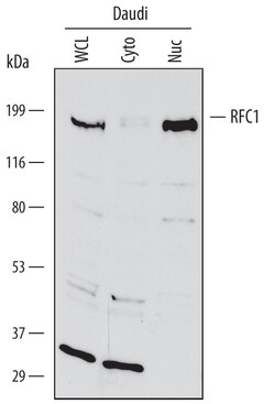 Human RFC1 Antibody, R D Systems 25&mu;g; Unlabeled:Antibodies, Polyclonal