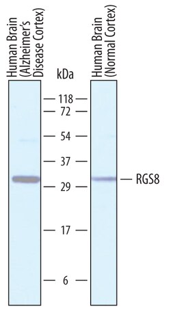 Human RGS8 Antibody, R D Systems 100 &mu;g | Buy Online | R&D Systems | Fisher Scientific