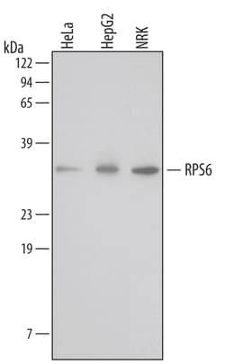 Human/Mouse/Rat Ribosomal Protein S6/RPS6 Antibody, R D Systems 100ug;