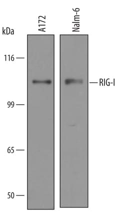 Human RIG-I Antibody, R D Systems 100&mu;g; Unlabeled:Antibodies, Polyclonal