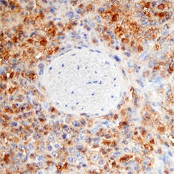 Human RIPK3/RIP3 Antibody, R D Systems 100ug; Unlabeled:Antibodies, Monoclonal