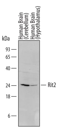 Human Rit2 Antibody, R D Systems 100ug; Unlabeled:Antibodies, Monoclonal